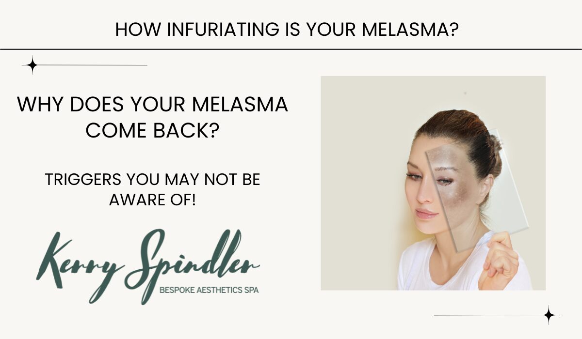 Melasma Come Back