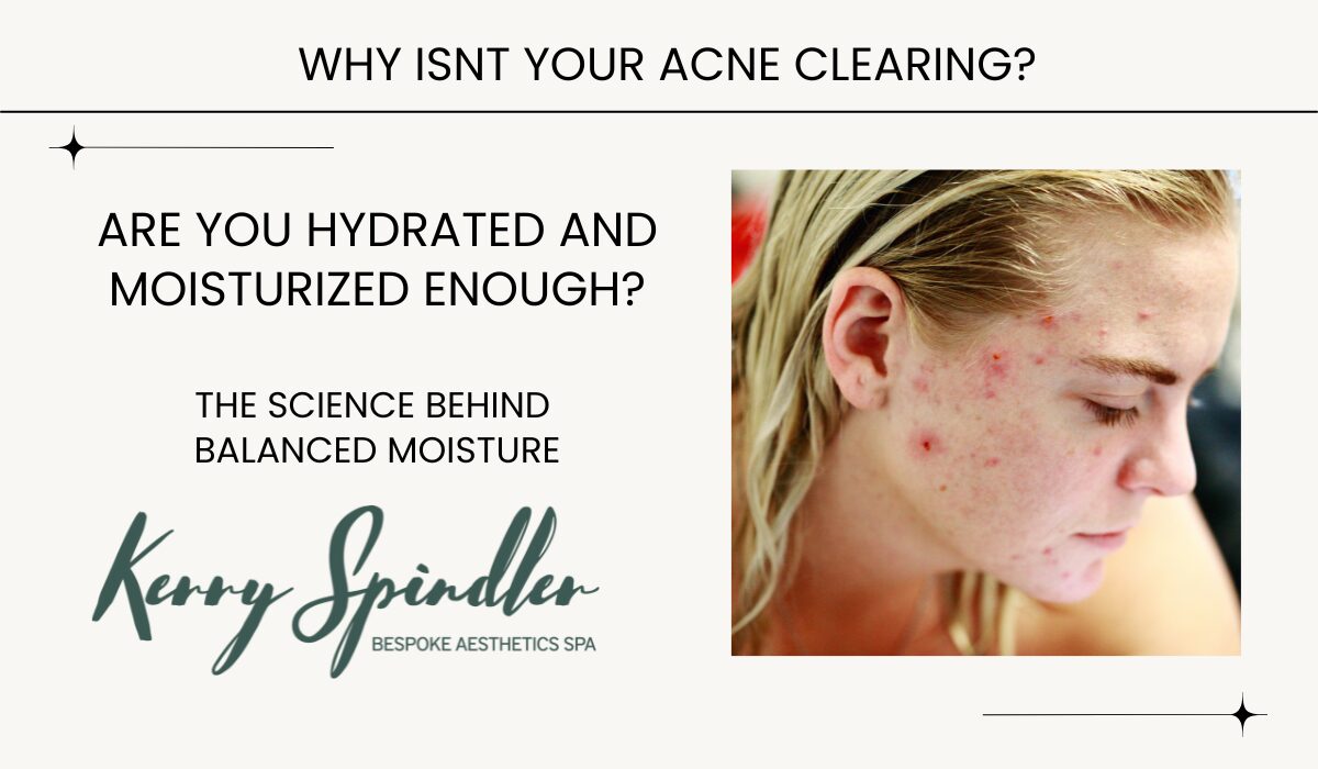 hydrating acne prone skin